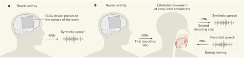 Brain implants that let you speak your mind