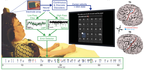 Feasibility of automatic error detect-and-undo system in human intracortical brain--computer interfaces