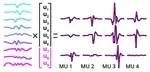 High performance sorting of motor unit action potentials with EMUsort