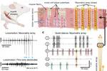 Myomatrix arrays for high-definition muscle recording