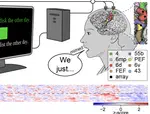 Restoring brain-to-text communication in a person with dysarthria from pontine stroke using an intracortical brain-computer interface