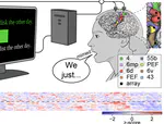 Restoring brain-to-text communication in a person with dysarthria from pontine stroke using an intracortical brain-computer interface