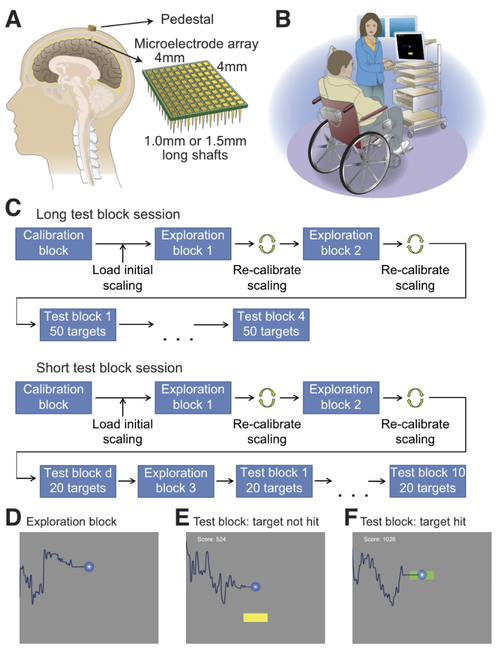 Volitional control of single-electrode high gamma local field potentials by people with paralysis